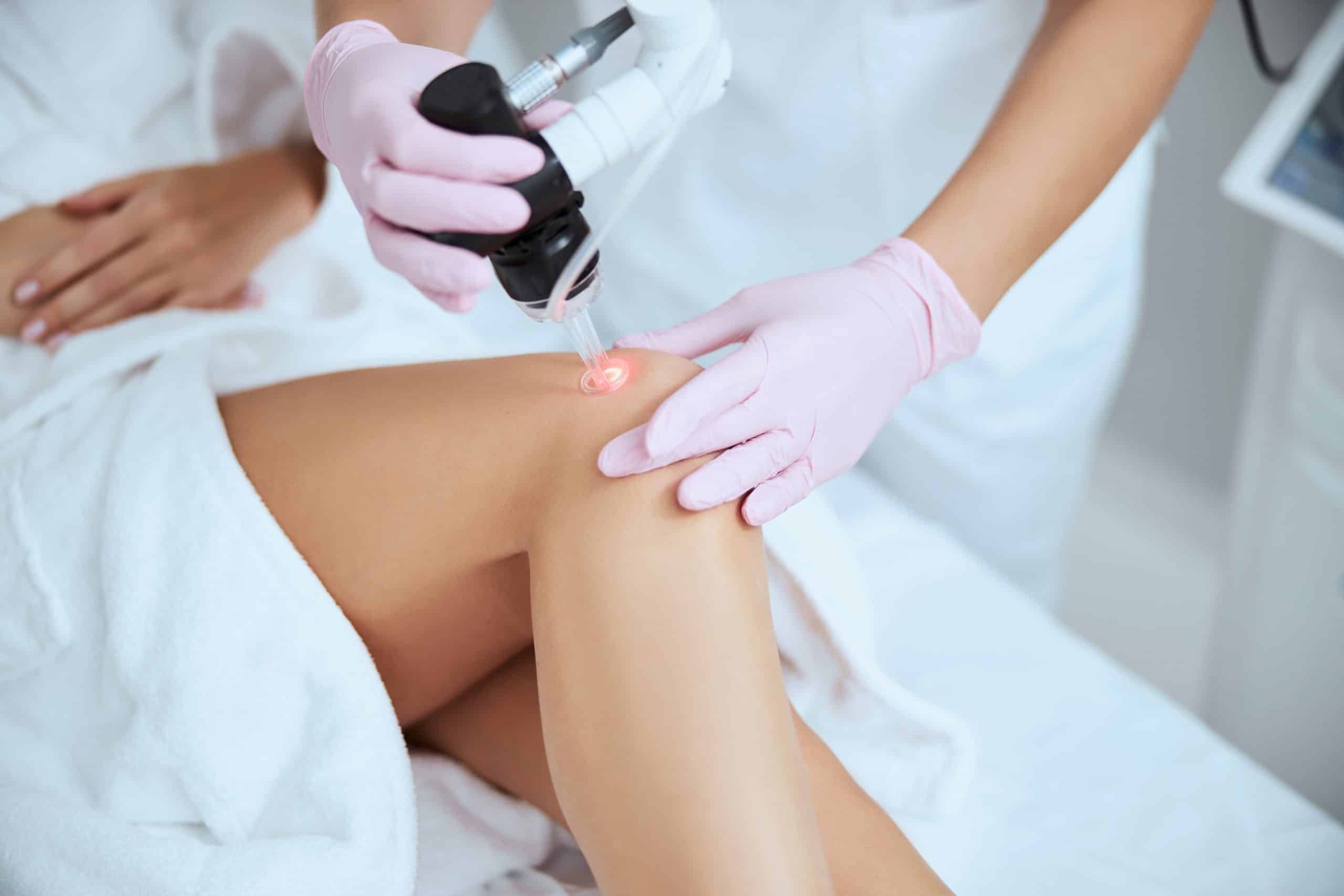 Can you get skin cancer from laser hair removal
