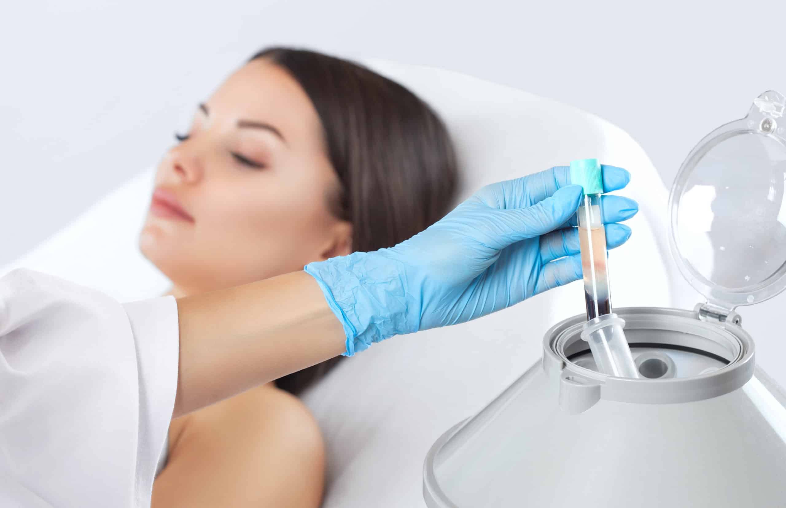 Understanding Platelet-Rich Plasma (PRP): How It Works and Its Benefits