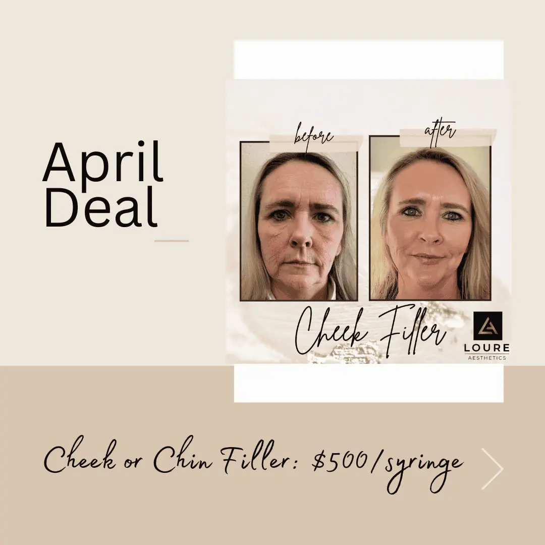 april deal 2