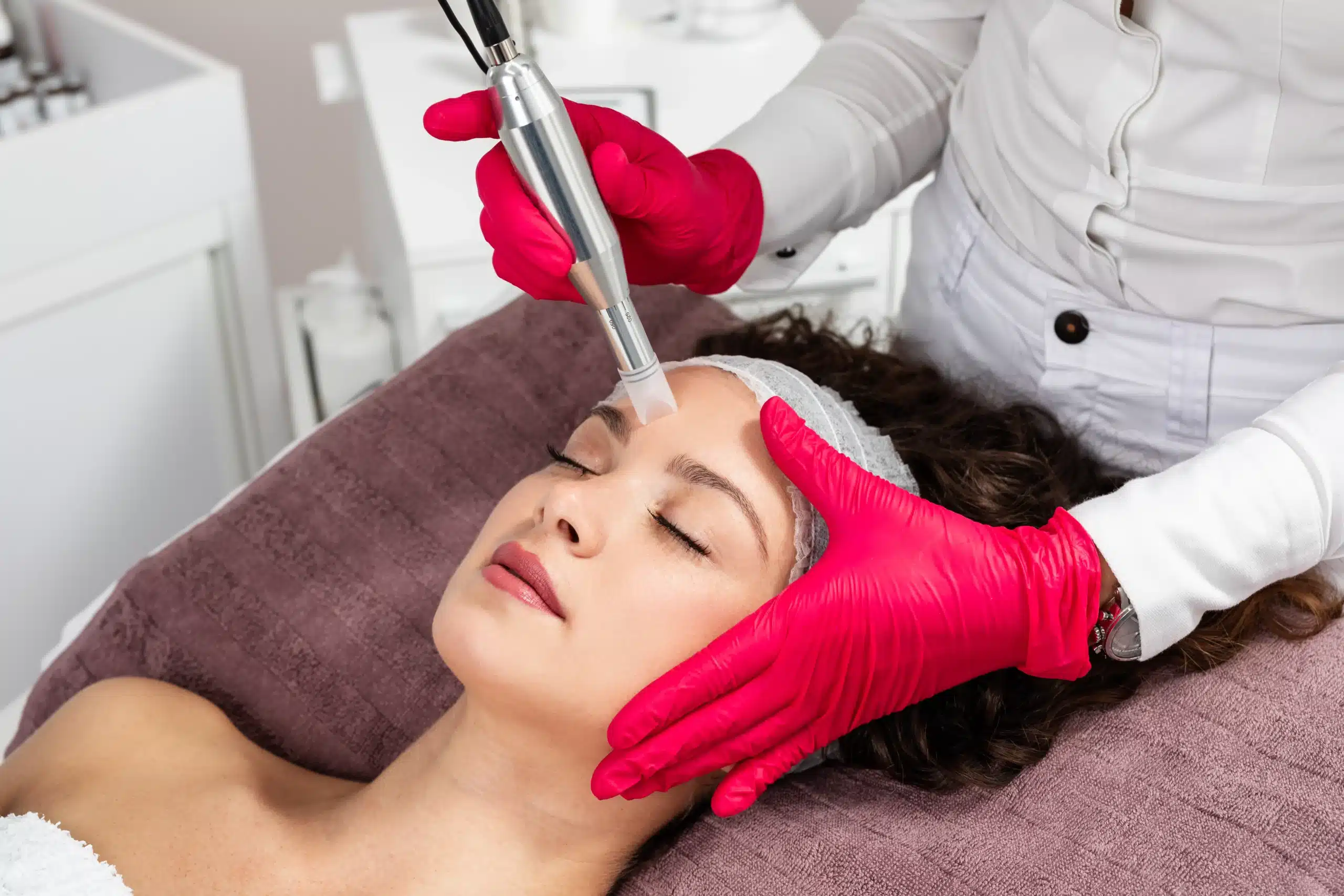 Microneedling