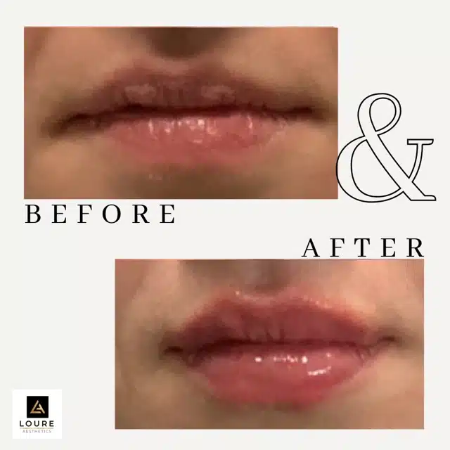 Minimal Lash Extensions Before and After Instagram Post 15