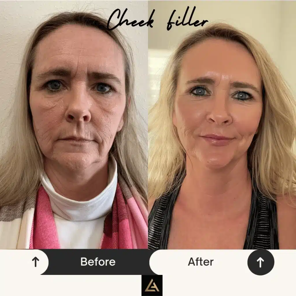 Beige Minimalist Skincare Before and After Instagram Post 1