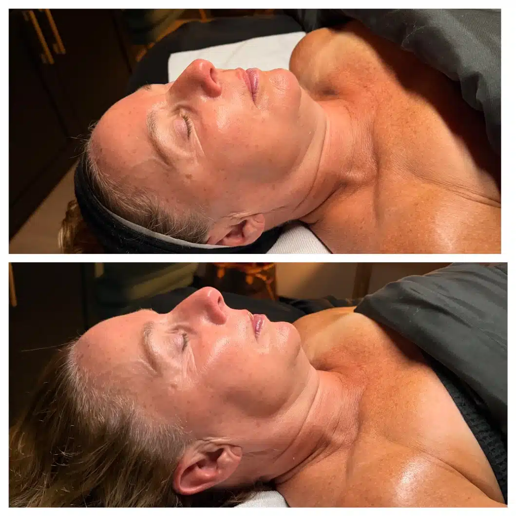 Facials 17 LOURE Luxe Lift facial A