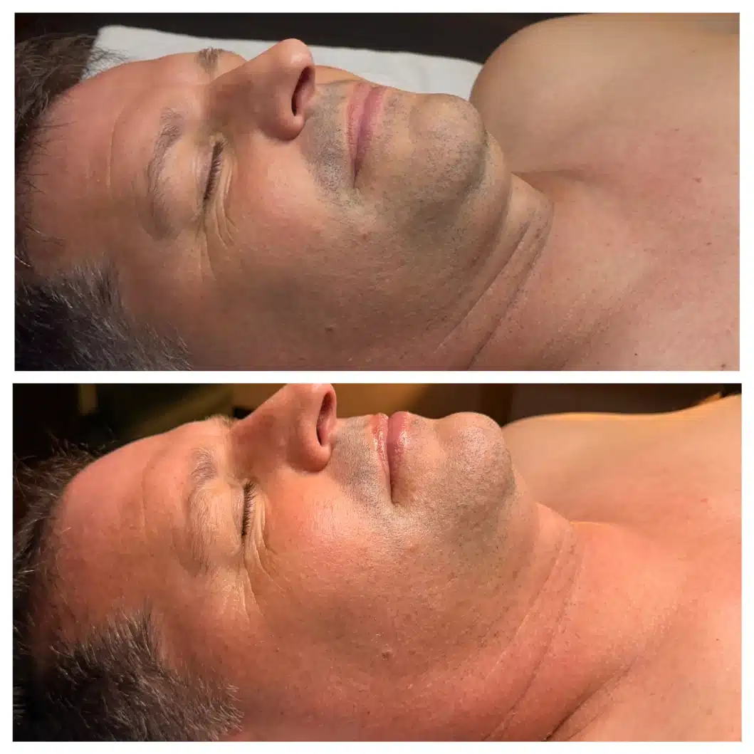 Facials 18 LOURE Luxe Lift facial B