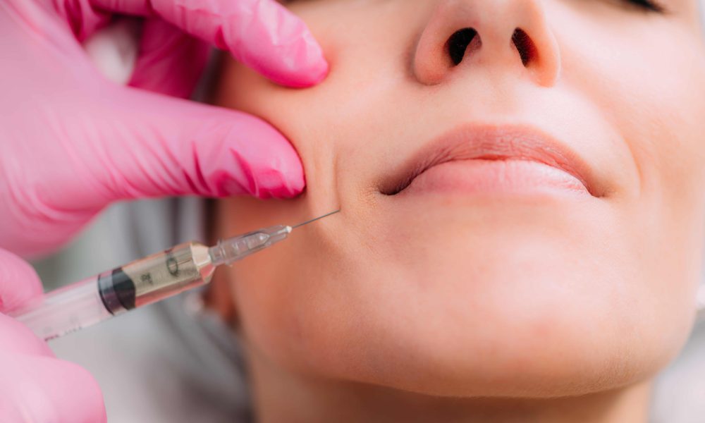 Common Treatment Areas for Dermal Fillers Lips, Cheeks, and Beyond
