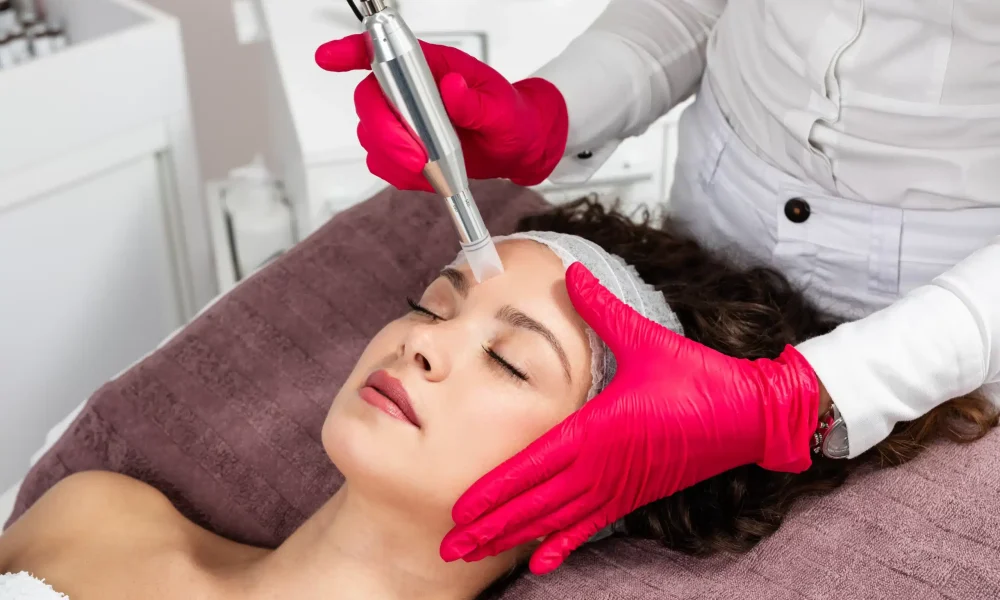 Microneedling