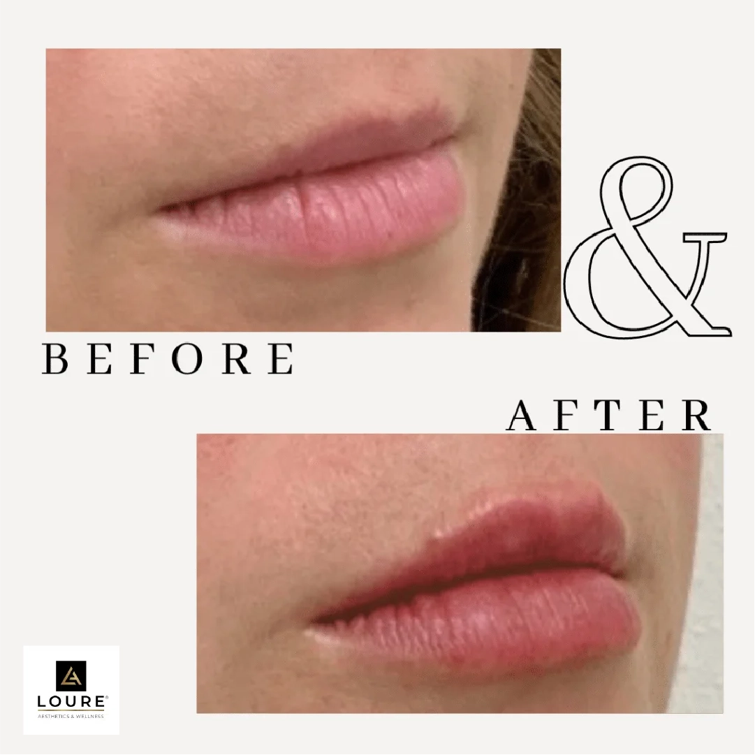 Lip