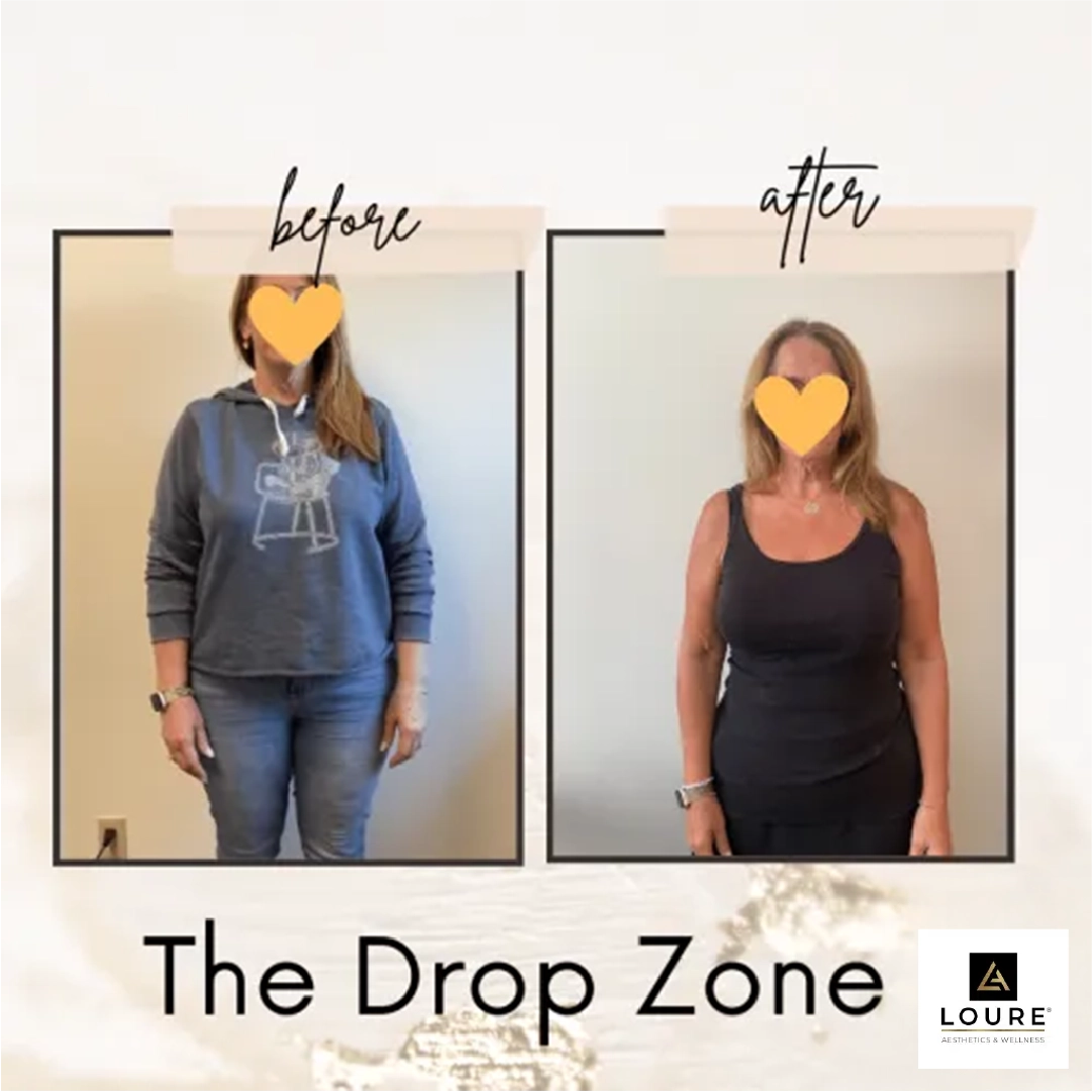 The Drop Zone Weight Loss Clinic in Waunakee, WI 13 Before and After Drop Zone