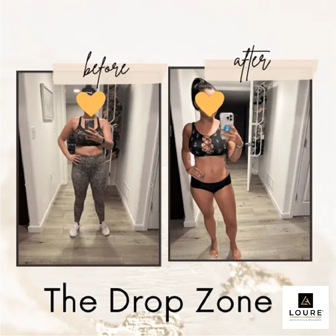 The Drop Zone Weight Loss Clinic in Waunakee, WI 12 Before and After weight loss